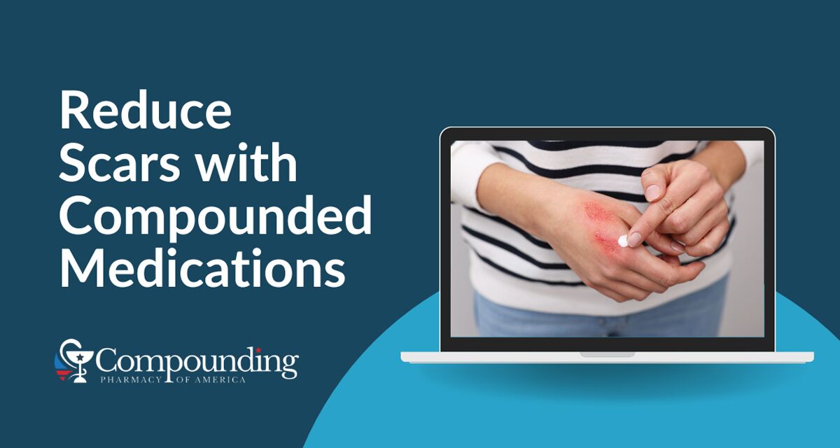 Reduce Scars with Compounded Medications