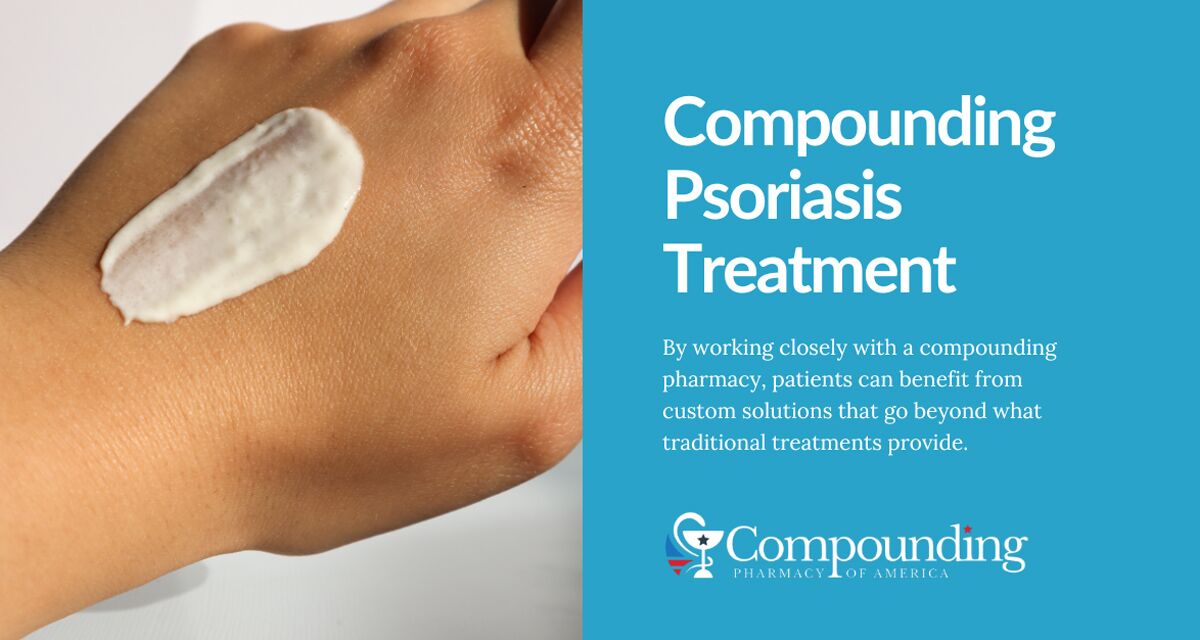 Compounding Psoriasis Treatment